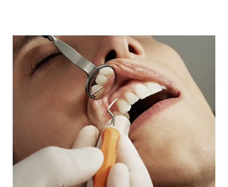 Espejos cóncavos utilizados para la ampliación en odontología